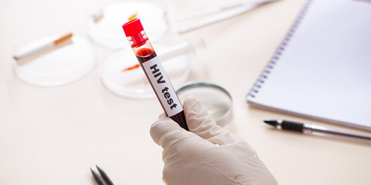 immagine di un test HIV